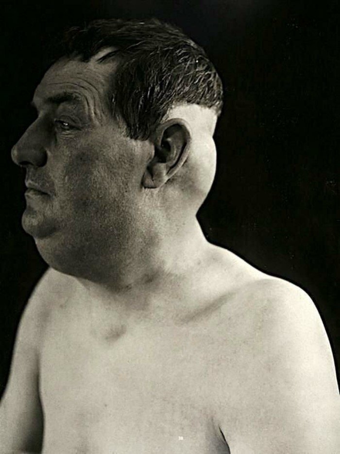 Пугающие портреты пациентов с аномалиями 19-го века