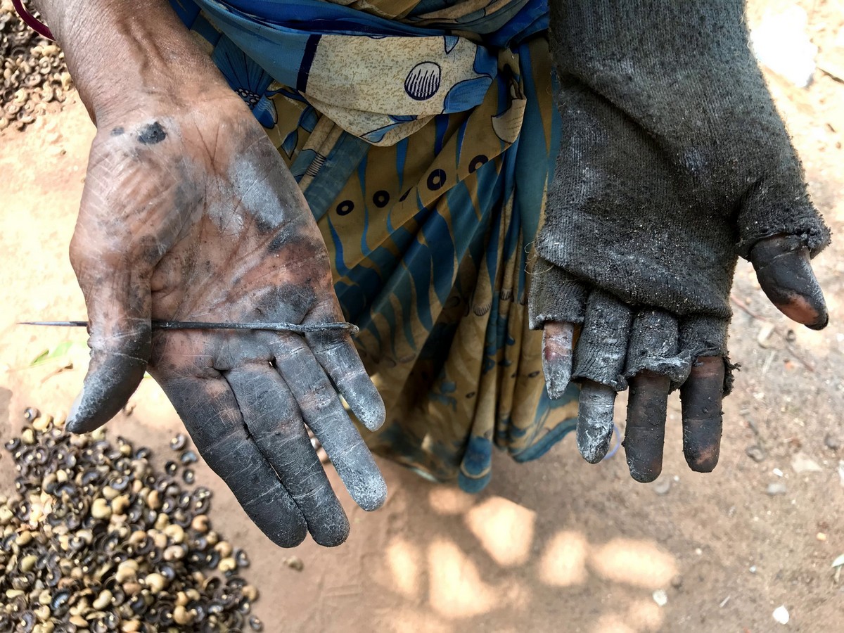 A kesudiókat feldolgozó nők leégett kezei