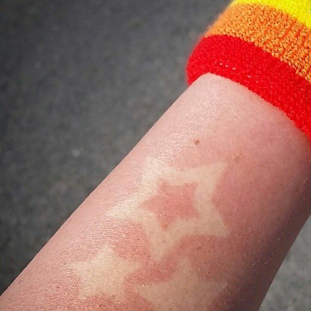 Популярные татуировки от солнца и загара