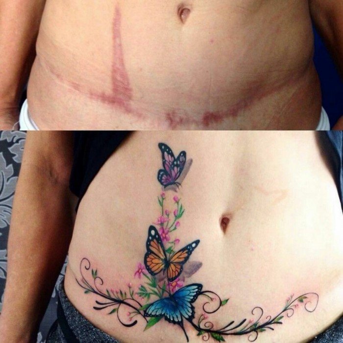 Мастера блестяще превратили шрамы в татуировки