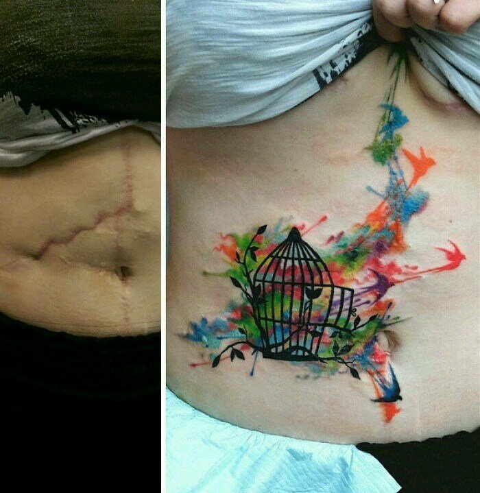 Мастера блестяще превратили шрамы в татуировки
