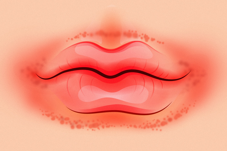 Что губы могут рассказать о проблемах со здоровьем