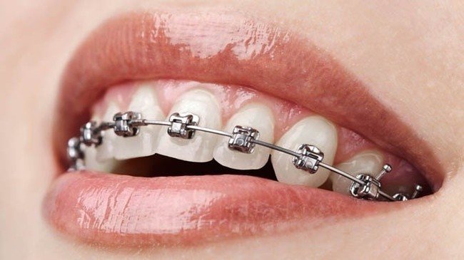 Удивительные факты о стоматологии будущего