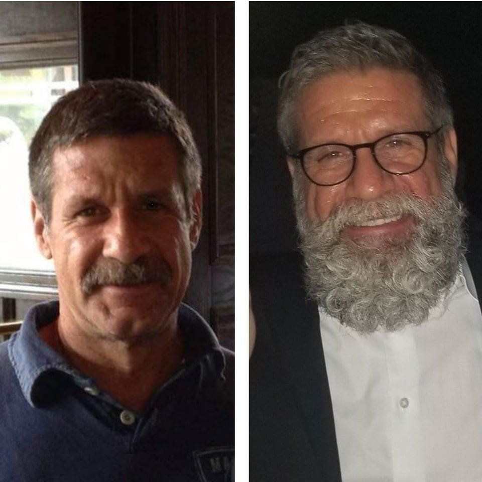 Мужчины с пышной бородой на снимках до и после