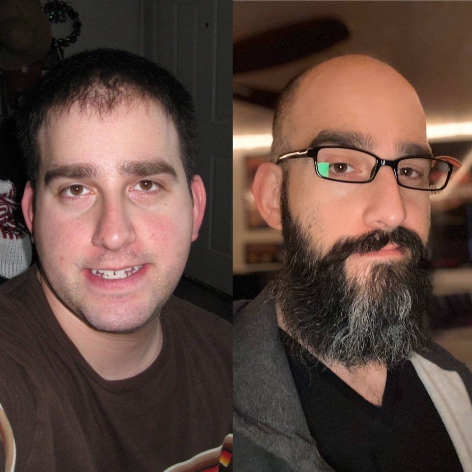 Мужчины с пышной бородой на снимках до и после