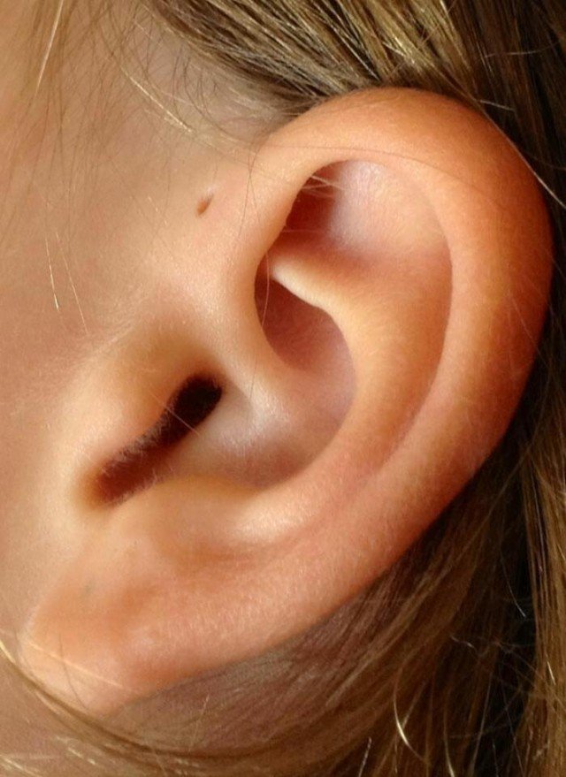 У некоторых людей есть маленькие отверстия на ушах, никто не знает зачем
