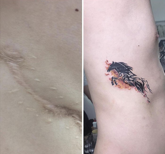 Татуировки, которые закрывают шрамы и другие дефекты на теле