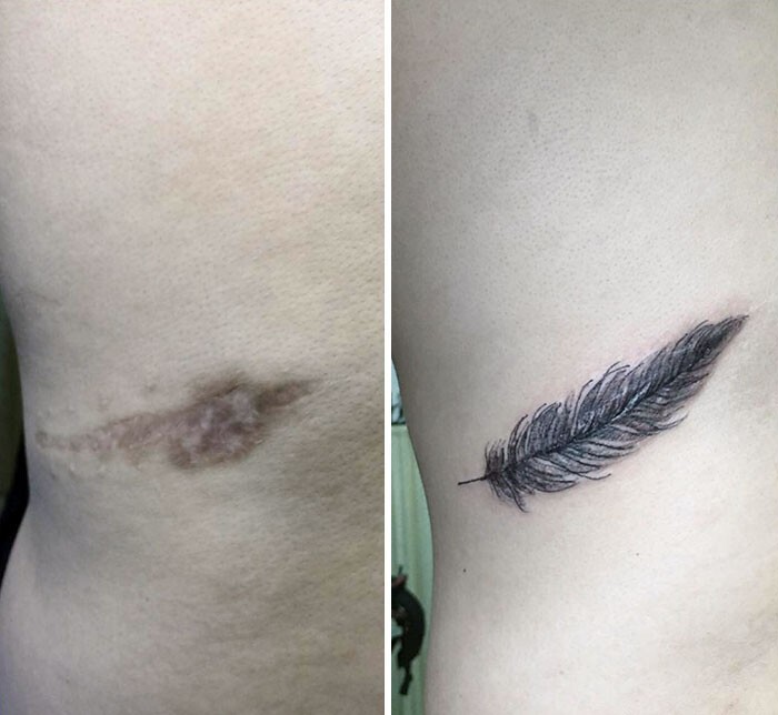 Татуировки, которые закрывают шрамы и другие дефекты на теле