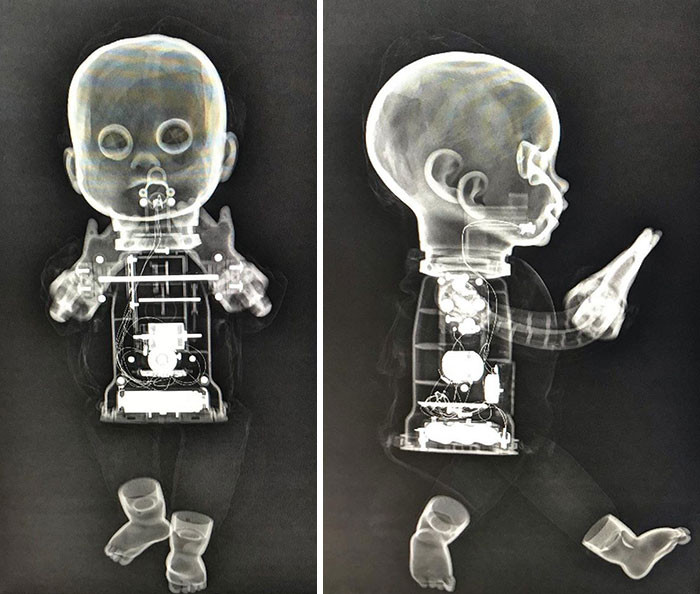 Рентгеновские снимки, которые показали интересные результаты
