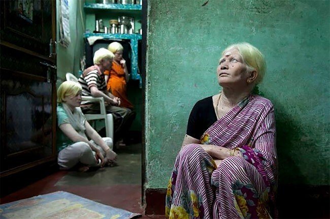 В Индии живет самая большая в мире семья альбиносов