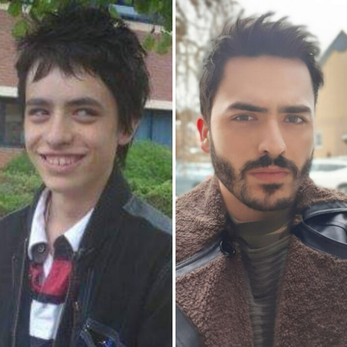 Люди показали, как они выглядели до и после того, как взялись за свою внешность
