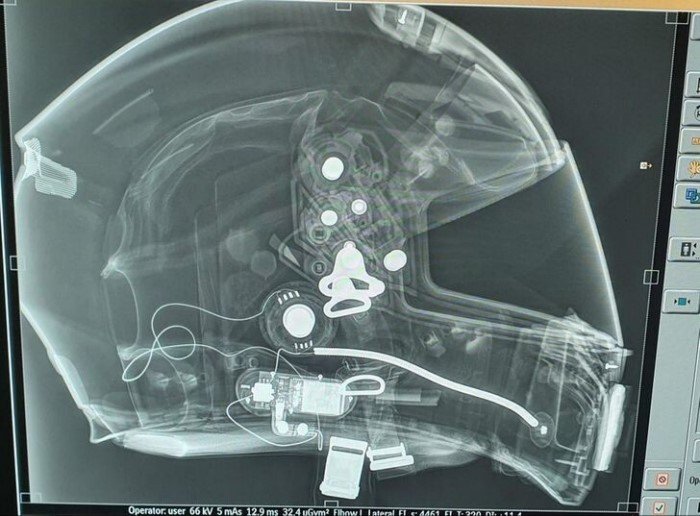 Разные странные и необычные рентгеновские снимки
