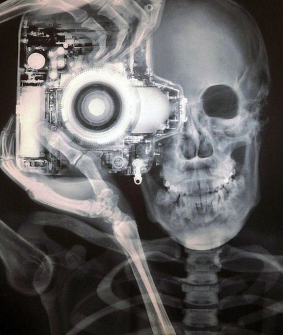 Удивительные и необычные рентгеновские снимки