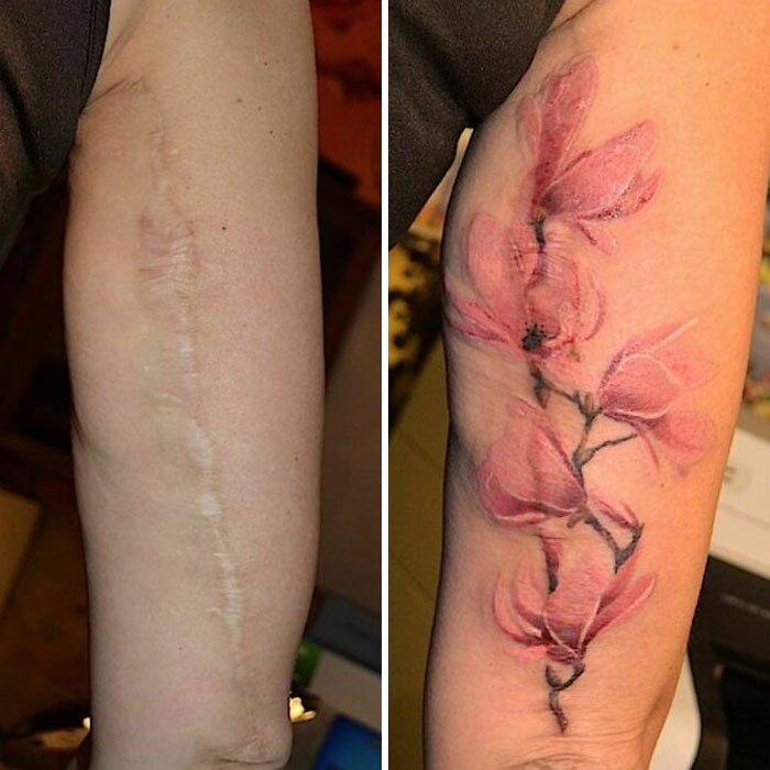 Кавер-ап татуировки, которые превратили изъяны кожи в произведения искусства