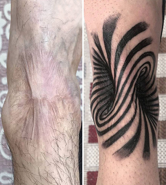 Кавер-ап татуировки, которые превратили изъяны кожи в произведения искусства
