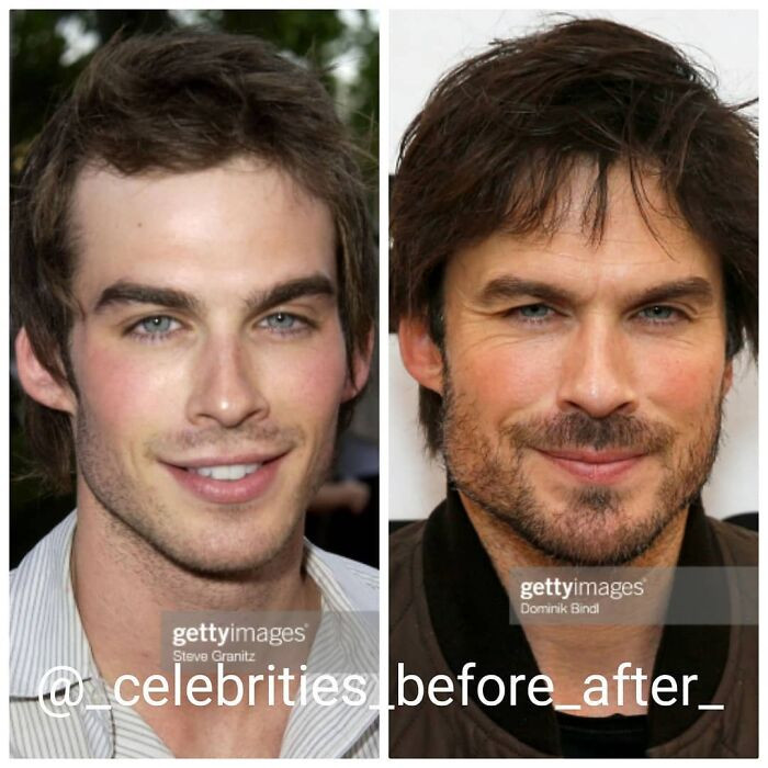 Сравнительные снимки знаменитостей показывают, насколько они изменились