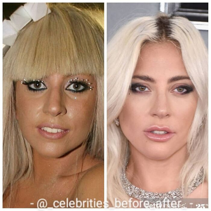 Сравнительные снимки знаменитостей показывают, насколько они изменились