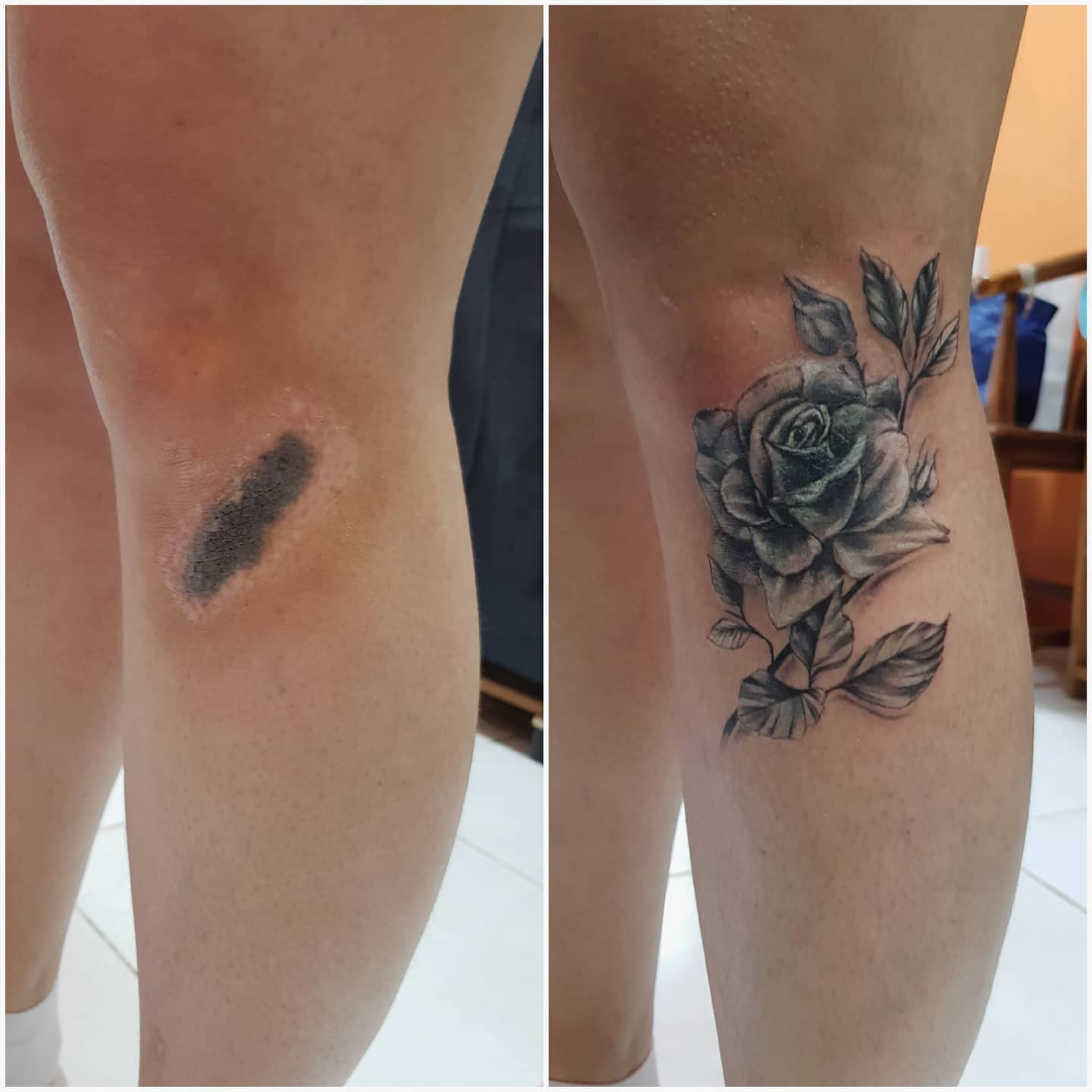 Татуировки, которые превращают недостатки кожи в изюминку