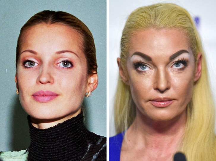 Как изменились российские знаменитости нулевых на снимках
