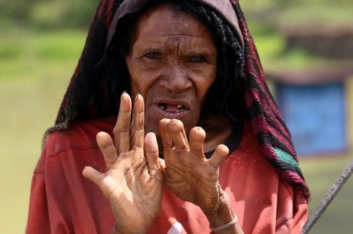 Для чего женщинам из племени Дани отрубают почти все пальцы