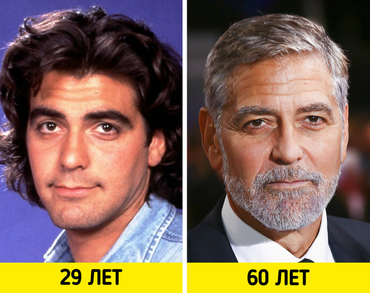 Как изменились лица актёров-красавчиков спустя годы