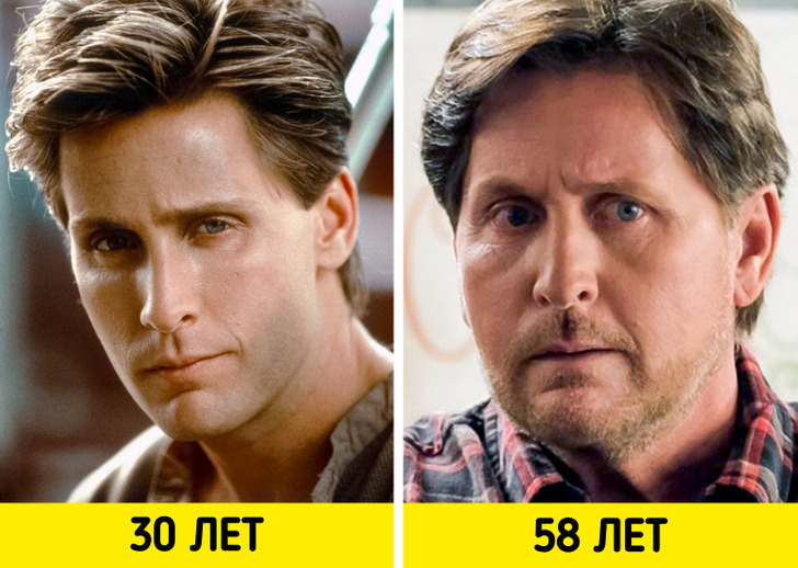 Как изменились лица актёров-красавчиков спустя годы