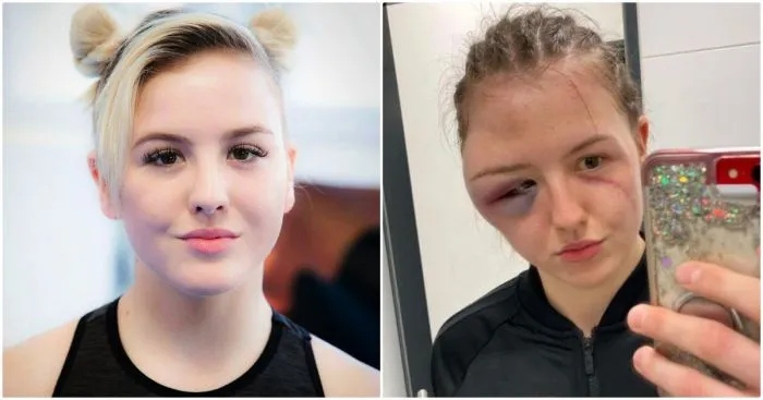 Как до и после боя выглядят девушки-спортсменки