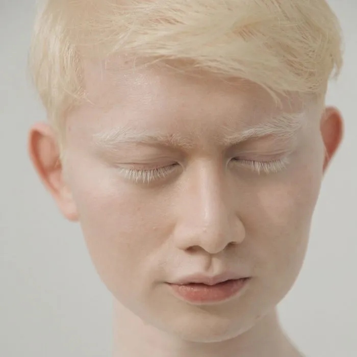 Люди с альбинизмом, которые похожи на инопланетян