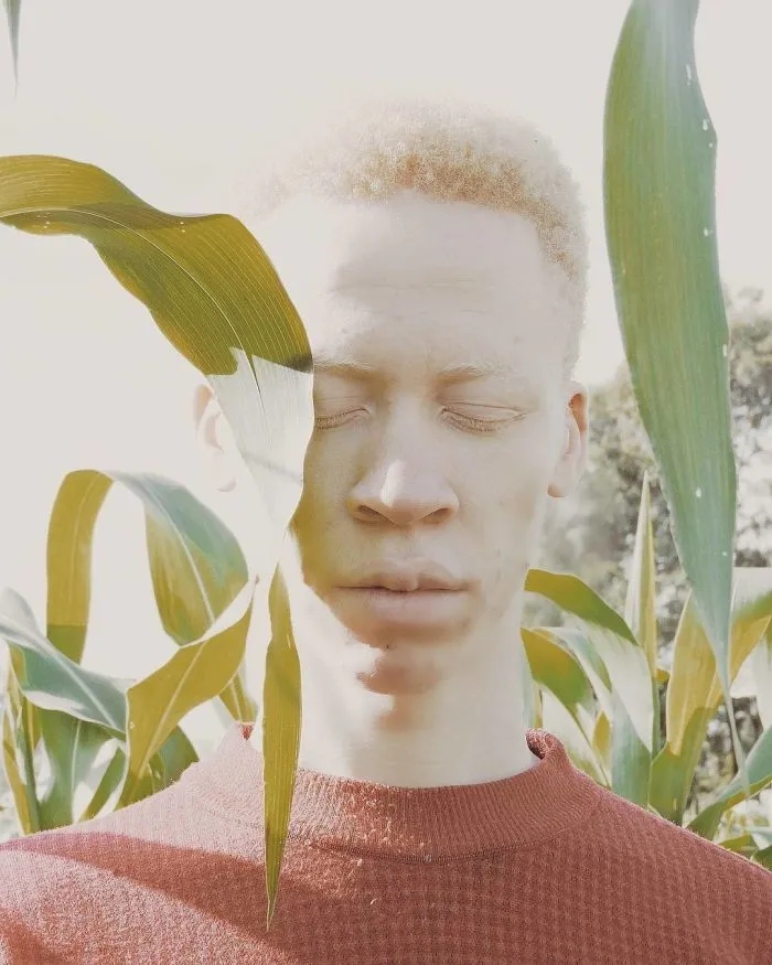 Люди с альбинизмом, которые похожи на инопланетян