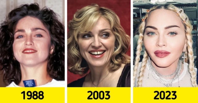Как изменились лица знаменитых музыкальных исполнителей