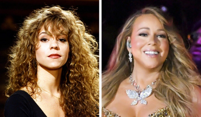 Как изменились лица знаменитых музыкальных исполнителей