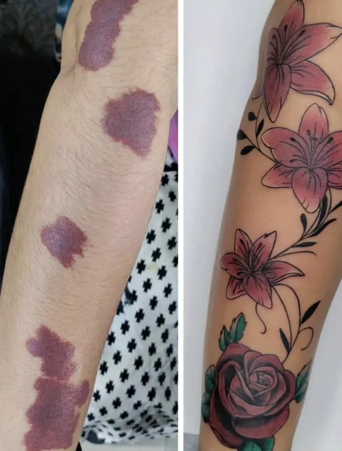 Оригінальні способи замаскувати шрам за допомогою татуювання
