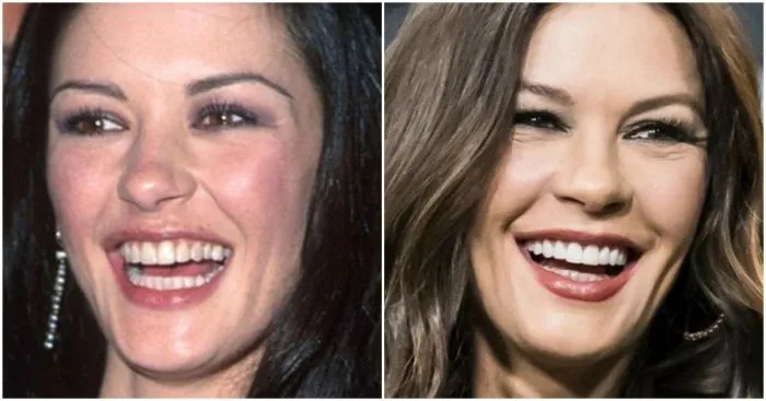 Как выглядели улыбки звёзд до того, как вмешались стоматологи