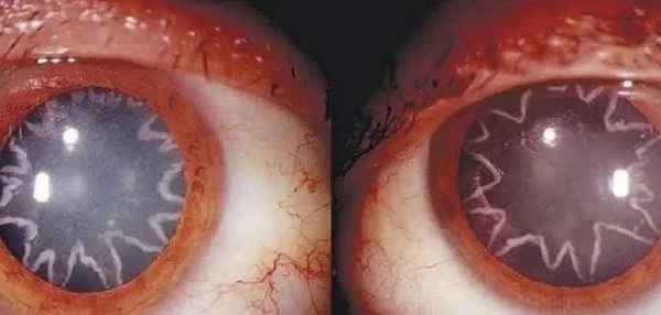 Странности и аномалии человеческого тела, от которых глаза лезут на лоб